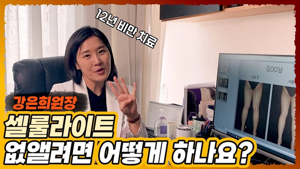 유튜브 썸네일 — 운동을 해도 셀룰라이트는 안 없어진다? 셀룰라이트 없애기 위한 방법은?