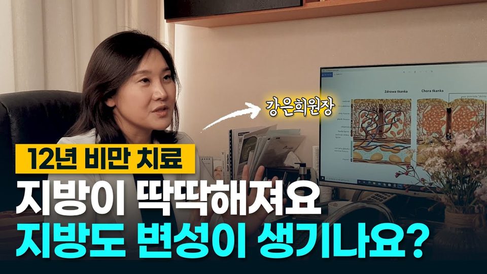 유튜브 썸네일 — [허벅지 지방 고민] 지방이 딱딱해진거 같은데요, 지방도 변성이 생기나요?