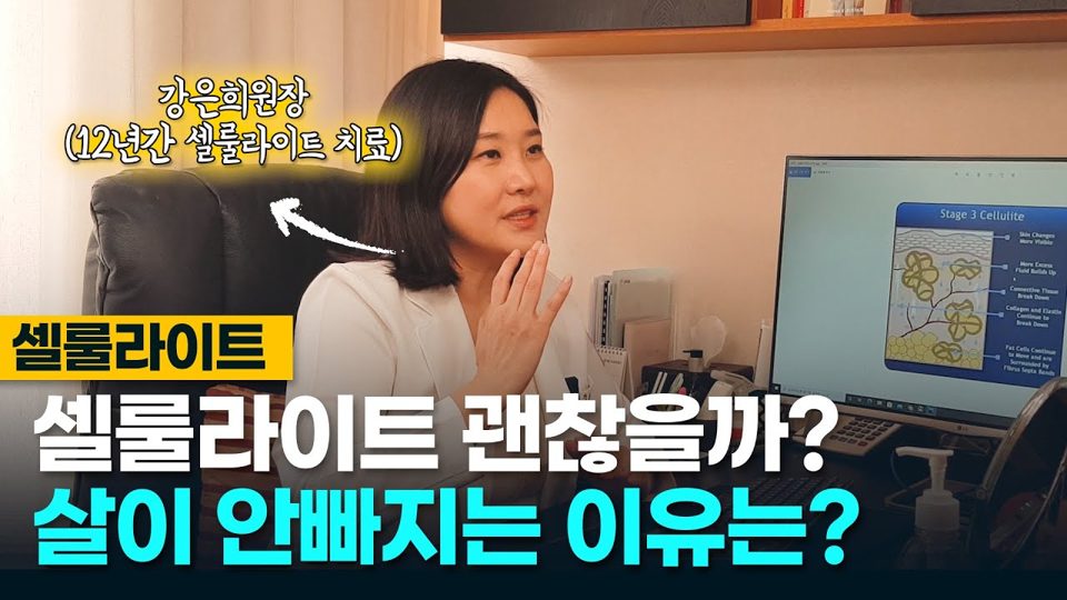 유튜브 썸네일 — 살을 뺄려면 셀룰라이트 제거부터 해야한다? 다이어트전 셀룰라이트 치료가 우선인 이유는?